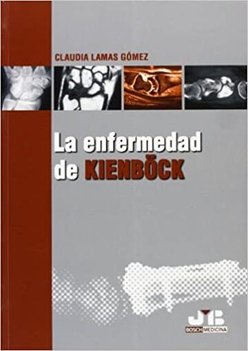 La enfermedad de Kienböck