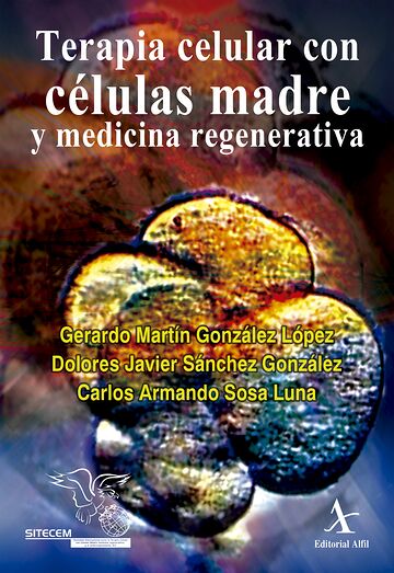 Terapia celular con células...