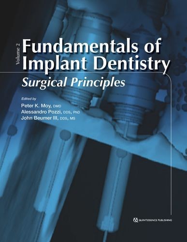 Fundamentals of Implant...