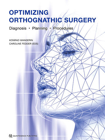 Optimizing Orthognathic...