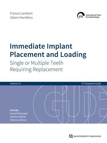 Immediate Implant Placement...
