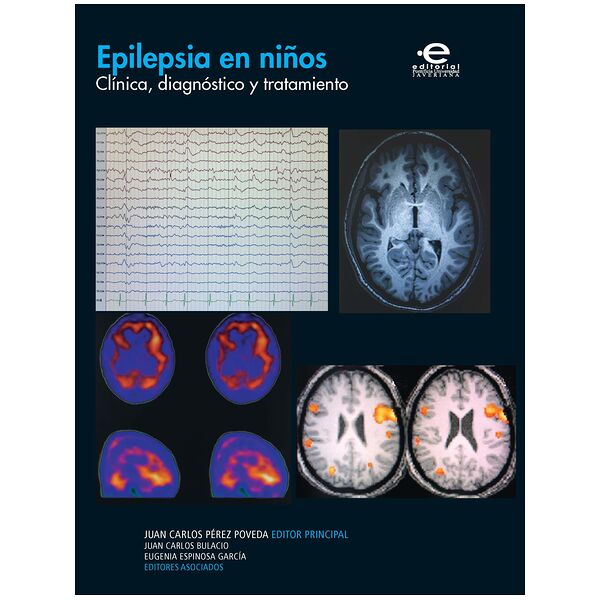 Epilepsia en niños....