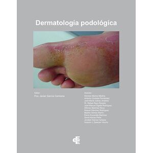 Dermatología Podológica