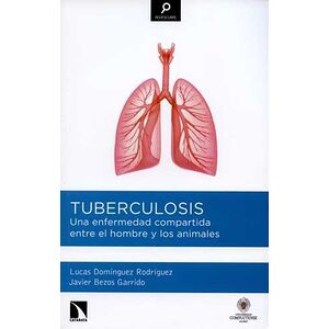 Tuberculosis. Una...