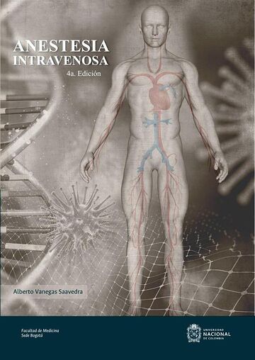 Anestesia intravenosa