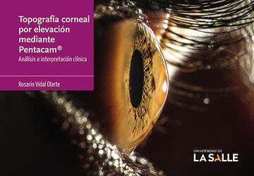 Topografía corneal por...
