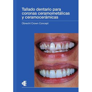 Tallado dentario para...