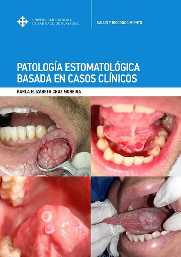Patología Estomatológica...