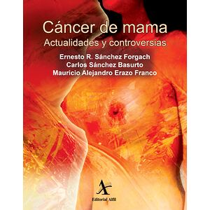 Cáncer de mama....