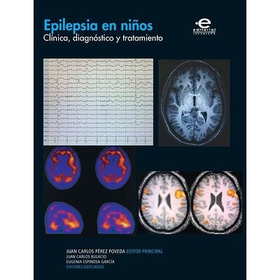 Epilepsia en niños