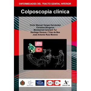 Colposcopia clínica