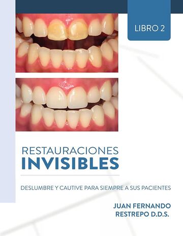 Restauraciones Invisibles:...