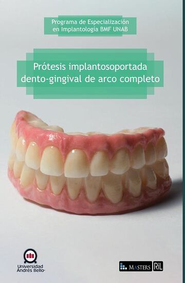 Prótesis implantosoportada...