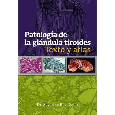 Patología de la glándula...