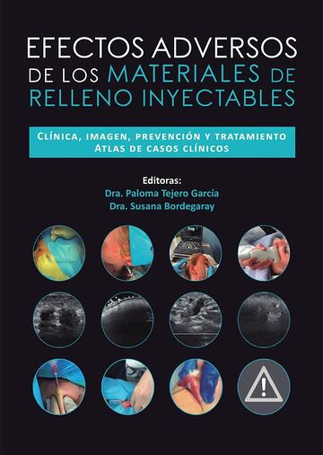 Efectos adversos de los...