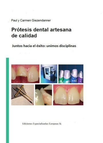 Prótesis dental artesanal...