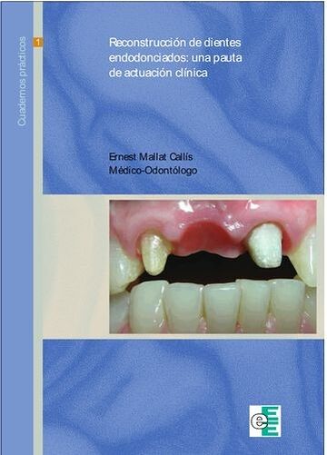 Reconstrucción de dientes...