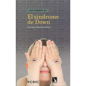 El síndrome de Down