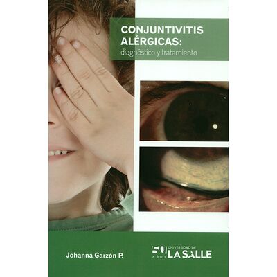 Conjuntivitis alérgicas:...