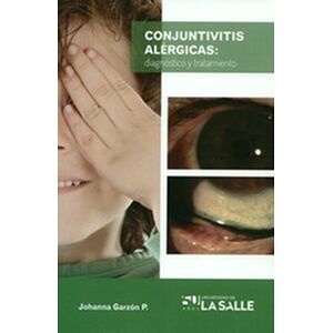 Conjuntivitis alérgicas:...