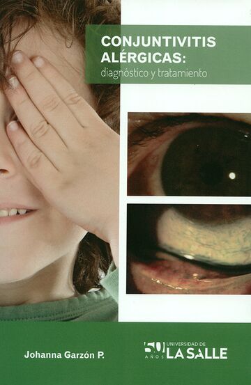 Conjuntivitis alérgicas:...