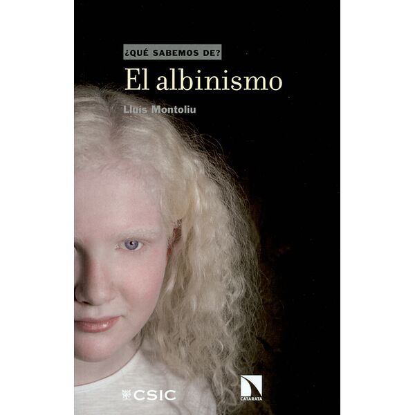 El albinismo