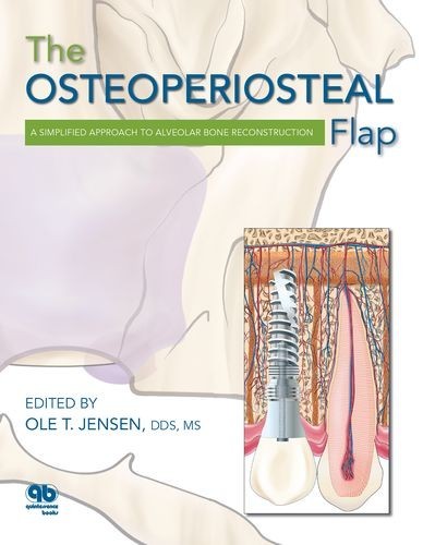 The Osteoperiosteal Flap
