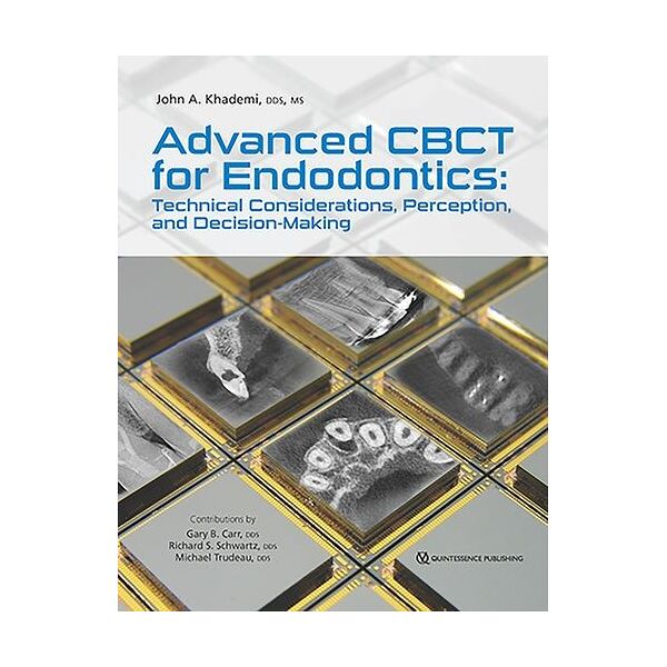 Advanced CBCT for Endodontics