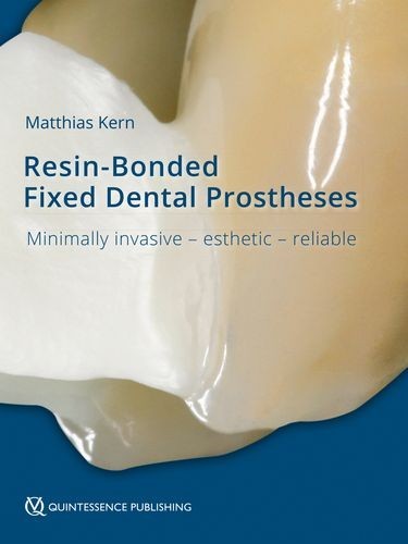 Resin-Bonded Fixed Dental...