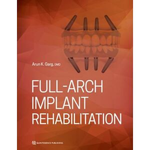 Full-Arch Implant...