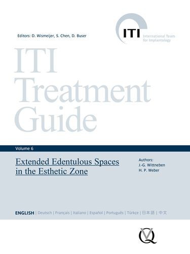 Extended Edentulous Spaces...