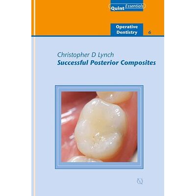 Successful Posterior...