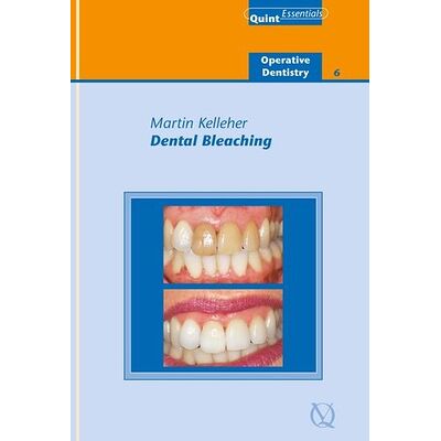 Dental Bleaching