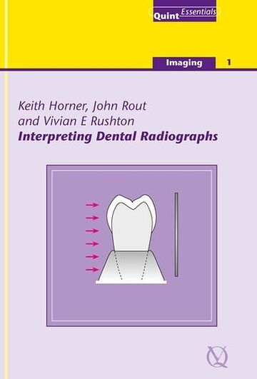 Interpreting Dental...