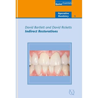 Indirect Restorations