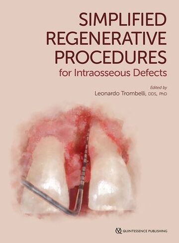 Simplified Regenerative...