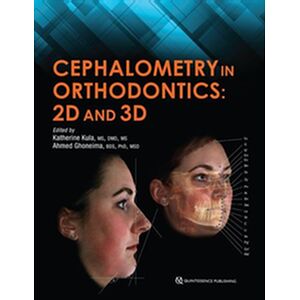 Cephalometry in Orthodontics
