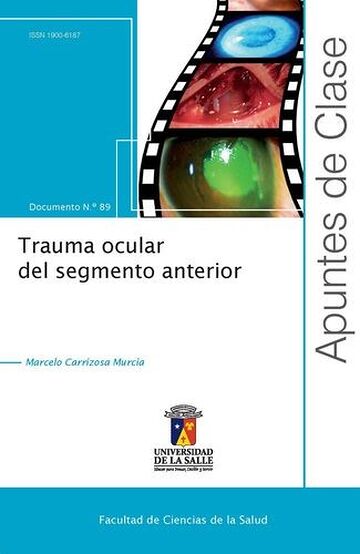 Trauma ocular del segmento...