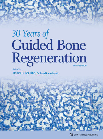 30 Years of Guided Bone...