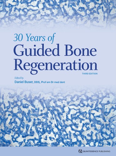 30 Years of Guided Bone...