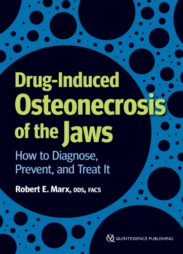 Drug-Induced Osteonecrosis...