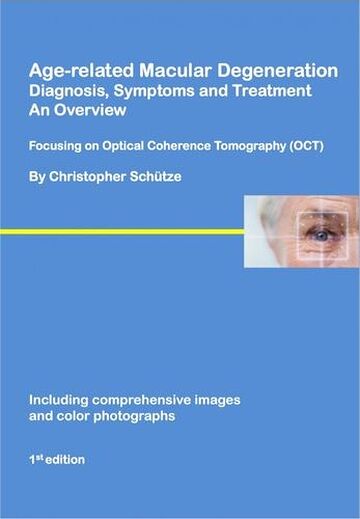 Age-related macular...