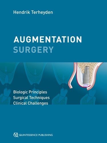 Augmentation Surgery