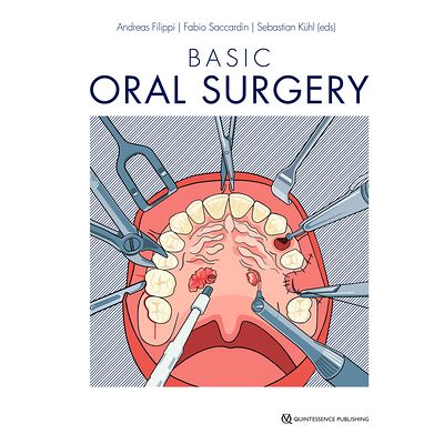 Basic Oral Surgery