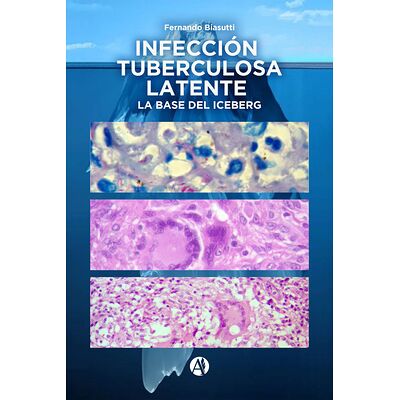 Infección Tuberculosa...
