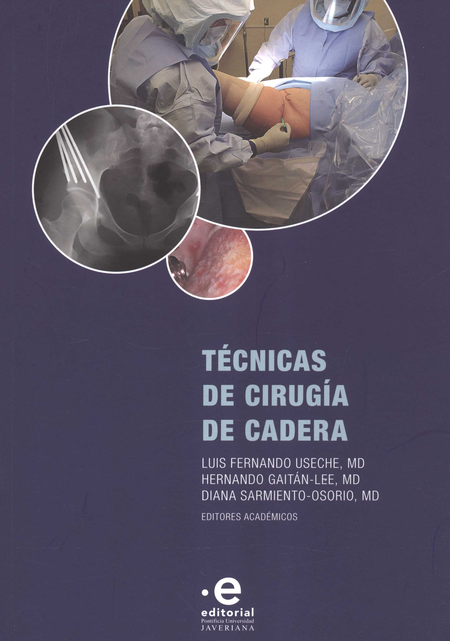 Portada de TECNICAS DE CIRUGIA DE CADERA de USECHE, Luis Fernando