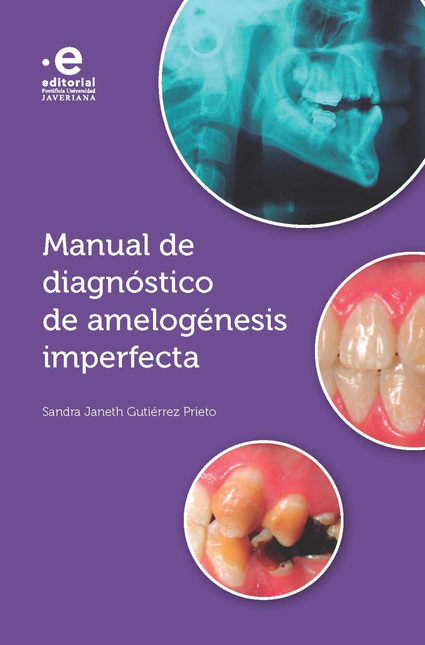 Portada de MANUAL DE DIAGNOSTICO DE AMELOGENESIS IMPERFECTA