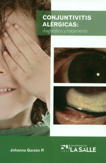 Portada de CONJUNTIVITIS ALERGICAS DIAGNOSTICO Y TRATAMIENTO