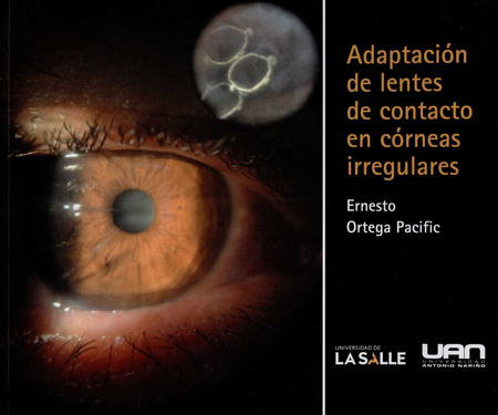 Portada de ADAPTACION DE LENTES DE CONTACTO EN CORNEAS IRREGULARES